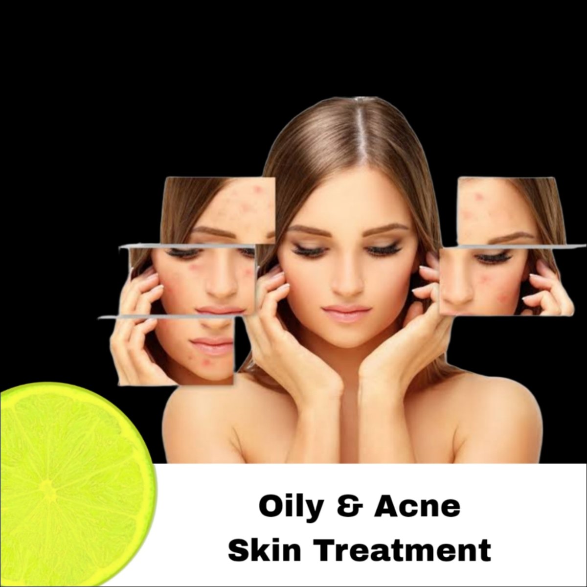 Best Cream for Oily & Acne-Prone Skin