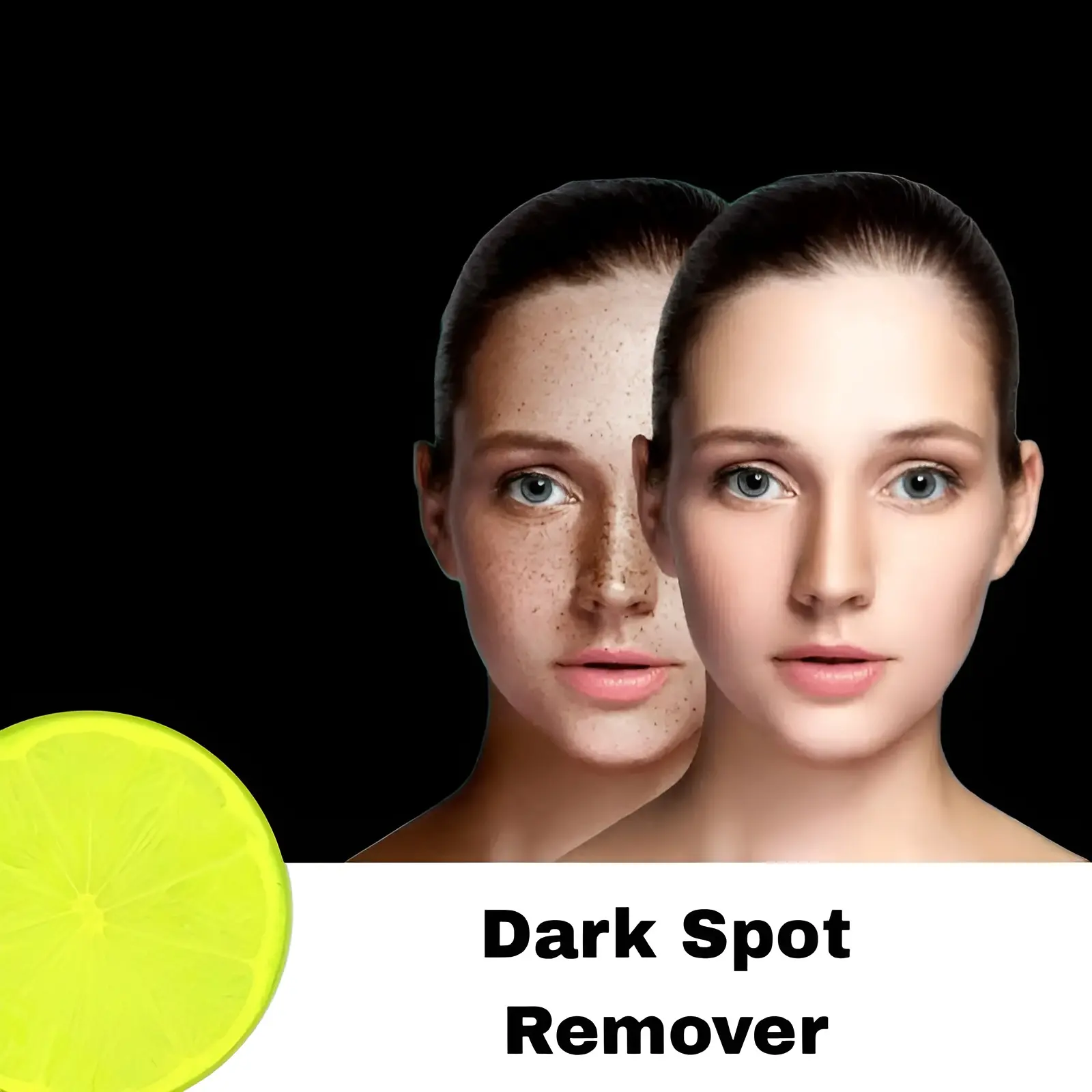 Best Dark Spot Removers – Fade Pigmentation & Achieve Clear Skin